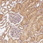 EEF1A1 Antibody in Immunohistochemistry (Paraffin) (IHC (P))