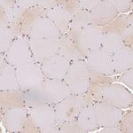 EEF1A1 Antibody in Immunohistochemistry (Paraffin) (IHC (P))