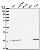 UBE2A Antibody in Western Blot (WB)