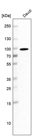 EWSR1 Polyclonal Antibody
