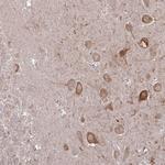 CaMKII alpha Antibody in Immunohistochemistry (Paraffin) (IHC (P))
