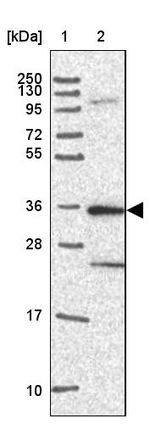 CaMKII alpha Antibody in Western Blot (WB)