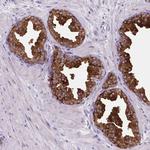 BCAS1 Antibody in Immunohistochemistry (Paraffin) (IHC (P))