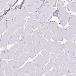 BCAS1 Antibody in Immunohistochemistry (Paraffin) (IHC (P))