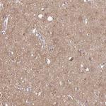 Talin 2 Antibody in Immunohistochemistry (Paraffin) (IHC (P))