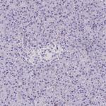 Talin 2 Polyclonal Antibody
