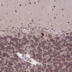 BRD3 Antibody in Immunohistochemistry (Paraffin) (IHC (P))