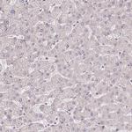 BRD3 Antibody in Immunohistochemistry (Paraffin) (IHC (P))