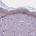 BRD3 Antibody in Immunohistochemistry (Paraffin) (IHC (P))