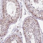 BRD3 Antibody in Immunohistochemistry (Paraffin) (IHC (P))