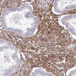 CD248 Antibody in Immunohistochemistry (Paraffin) (IHC (P))