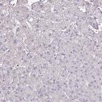 CD248 Antibody in Immunohistochemistry (Paraffin) (IHC (P))
