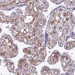 CD248 Antibody in Immunohistochemistry (Paraffin) (IHC (P))