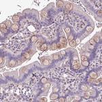 CD248 Antibody in Immunohistochemistry (Paraffin) (IHC (P))
