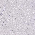 MYL4 Antibody in Immunohistochemistry (Paraffin) (IHC (P))