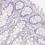 MYL4 Antibody in Immunohistochemistry (Paraffin) (IHC (P))