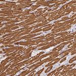 MYL4 Antibody in Immunohistochemistry (Paraffin) (IHC (P))