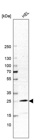 MYL4 Antibody in Western Blot (WB)