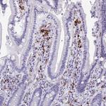 CD163 Antibody in Immunohistochemistry (Paraffin) (IHC (P))