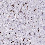 CD163 Antibody in Immunohistochemistry (Paraffin) (IHC (P))