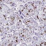 CD163 Antibody in Immunohistochemistry (Paraffin) (IHC (P))