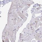 CD163 Antibody in Immunohistochemistry (Paraffin) (IHC (P))