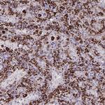 CD163 Antibody in Immunohistochemistry (Paraffin) (IHC (P))