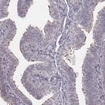 IQCG Antibody in Immunohistochemistry (Paraffin) (IHC (P))