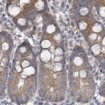 RPL32 Antibody in Immunohistochemistry (Paraffin) (IHC (P))