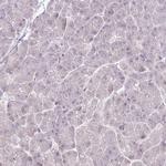 PARP2 Antibody in Immunohistochemistry (Paraffin) (IHC (P))