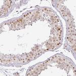 PARP2 Antibody in Immunohistochemistry (Paraffin) (IHC (P))