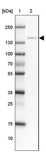 C/EBP zeta Antibody in Western Blot (WB)