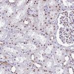 PUF60 Antibody in Immunohistochemistry (Paraffin) (IHC (P))