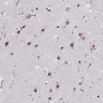 PUF60 Antibody in Immunohistochemistry (Paraffin) (IHC (P))