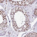 PUF60 Antibody in Immunohistochemistry (Paraffin) (IHC (P))