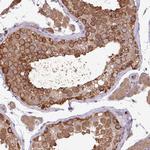 KIR3DX1 Polyclonal Antibody