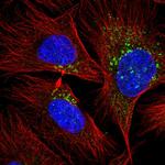 RAB20 Polyclonal Antibody