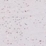 TBX15 Polyclonal Antibody