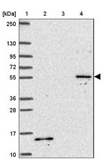 TBX15 Antibody in Western Blot (WB)