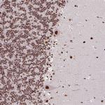 TDG Antibody in Immunohistochemistry (Paraffin) (IHC (P))