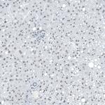 SUV420H2 Antibody in Immunohistochemistry (Paraffin) (IHC (P))