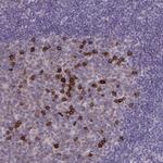CD38 Antibody in Immunohistochemistry (Paraffin) (IHC (P))