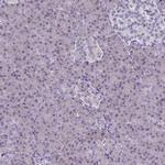 CD38 Antibody in Immunohistochemistry (Paraffin) (IHC (P))