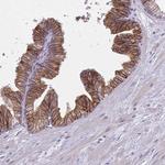 CD38 Antibody in Immunohistochemistry (Paraffin) (IHC (P))