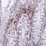 CD38 Antibody in Immunohistochemistry (Paraffin) (IHC (P))