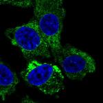 RTBDN Polyclonal Antibody