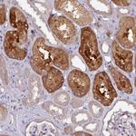 CTDSP2 Polyclonal Antibody