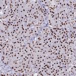 NFIC Antibody in Immunohistochemistry (Paraffin) (IHC (P))