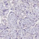NFIC Antibody in Immunohistochemistry (Paraffin) (IHC (P))