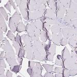 NFIC Antibody in Immunohistochemistry (Paraffin) (IHC (P))